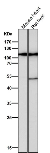 Anti-Hexokinase 1 HK1 Rabbit Monoclonal Antibody Boster Bio