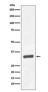 Anti-PSA/KLK3 Rabbit Monoclonal Antibody Boster Bio