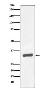 Anti-PSA/KLK3 Rabbit Monoclonal Antibody Boster Bio