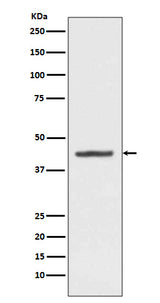 Anti-HMBS Rabbit Monoclonal Antibody Boster Bio