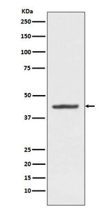 Anti-HMBS Rabbit Monoclonal Antibody Boster Bio