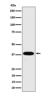 Anti-Cathepsin H Rabbit Monoclonal Antibody Boster Bio