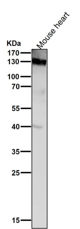 Anti-CD31 PECAM1 Rabbit Monoclonal Antibody Boster Bio