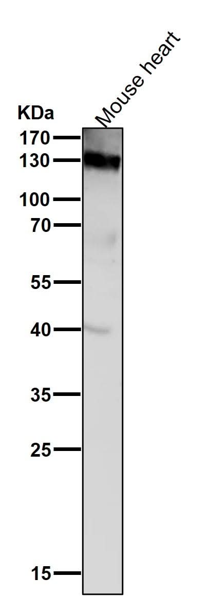 Anti-CD31 PECAM1 Rabbit Monoclonal Antibody Boster Bio