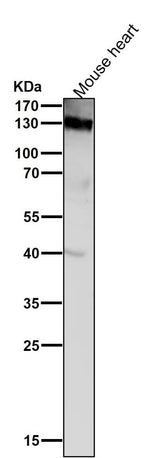 Anti-CD31 PECAM1 Rabbit Monoclonal Antibody Boster Bio