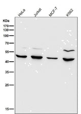 Anti-MMP12 Rabbit Monoclonal Antibody Boster Bio