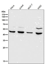 Anti-MMP12 Rabbit Monoclonal Antibody Boster Bio
