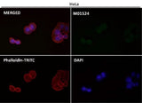 Anti-LC3B MAP1LC3B Rabbit Monoclonal Antibody Boster Bio