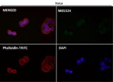 Anti-LC3B MAP1LC3B Rabbit Monoclonal Antibody Boster Bio