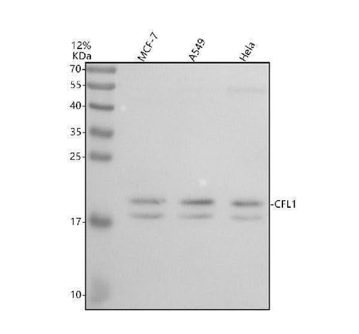 Anti-Cofilin Rabbit Monoclonal Antibody Boster Bio