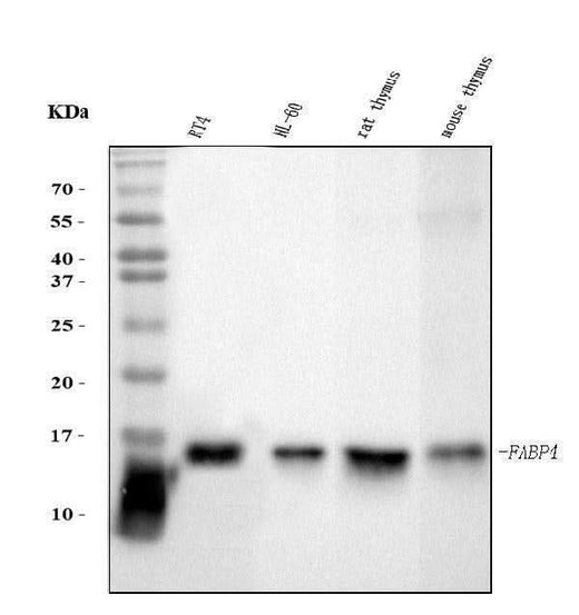 Anti-FABP4 Antibody Picoband® (monoclonal, 10E12 Boster Bio