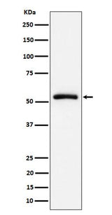Anti-CAP1 Rabbit Monoclonal Antibody Boster Bio