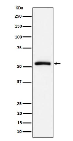 Anti-CAP1 Rabbit Monoclonal Antibody Boster Bio