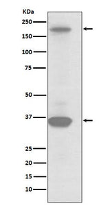Anti-RON Rabbit Monoclonal Antibody Boster Bio