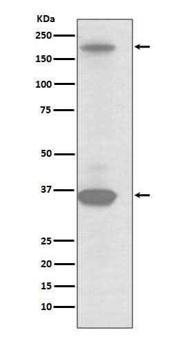 Anti-RON Rabbit Monoclonal Antibody Boster Bio
