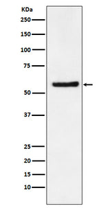 Anti-DKC1 Rabbit Monoclonal Antibody Boster Bio