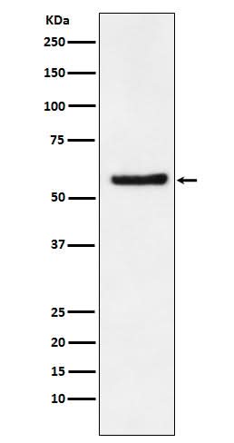 Anti-DKC1 Rabbit Monoclonal Antibody Boster Bio