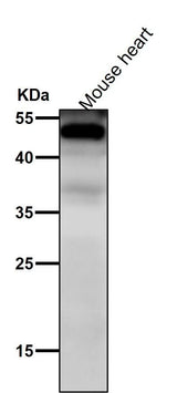 Anti-NFIB / NF1B2 Rabbit Monoclonal Antibody Boster Bio
