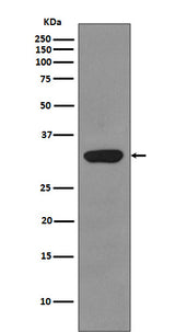 Anti-RPS3/Ribosomal Protein S3 Rabbit Monoclonal Antibody Boster Bio
