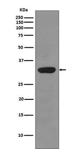 Anti-RPS3/Ribosomal Protein S3 Rabbit Monoclonal Antibody Boster Bio