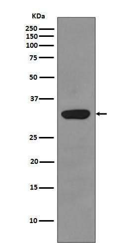 Anti-RPS3/Ribosomal Protein S3 Rabbit Monoclonal Antibody Boster Bio
