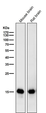 Anti-MAP1LC3A/Lc3A Rabbit Monoclonal Antibody Boster Bio