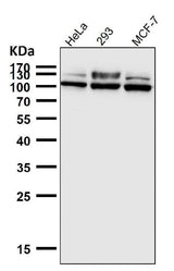 Anti-GAA Rabbit Monoclonal Antibody Boster Bio