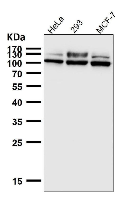 Anti-GAA Rabbit Monoclonal Antibody Boster Bio