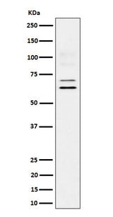 Anti-BIN1 Rabbit Monoclonal Antibody Boster Bio