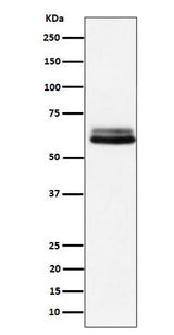 Anti-BIN1 Rabbit Monoclonal Antibody Boster Bio