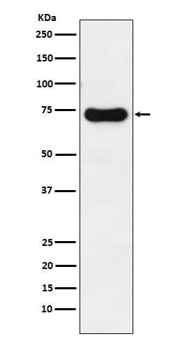 Anti-IRAK2 Rabbit Monoclonal Antibody Boster Bio