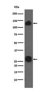 Anti-Integrin alpha V ITGAV Rabbit Monoclonal Antibody Boster Bio
