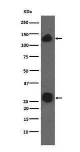 Anti-Integrin alpha V ITGAV Rabbit Monoclonal Antibody Boster Bio