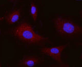 Anti-Integrin alpha V/ITGAV Antibody Picoband® (monoclonal, 8B10H2 Boster Bio