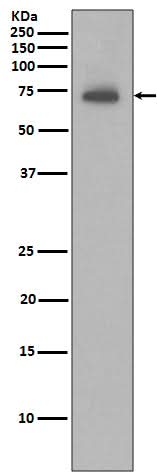 Anti-IAP2 BIRC3 Rabbit Monoclonal Antibody Boster Bio