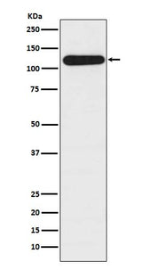 Anti-BubR1 BUB1B Rabbit Monoclonal Antibody Boster Bio