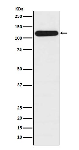 Anti-BubR1 BUB1B Rabbit Monoclonal Antibody Boster Bio