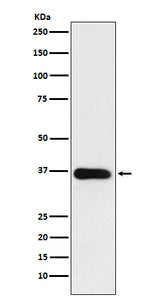 Anti-HSD11B1 Rabbit Monoclonal Antibody Boster Bio