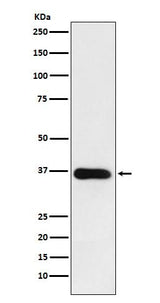 Anti-HSD11B1 Rabbit Monoclonal Antibody Boster Bio