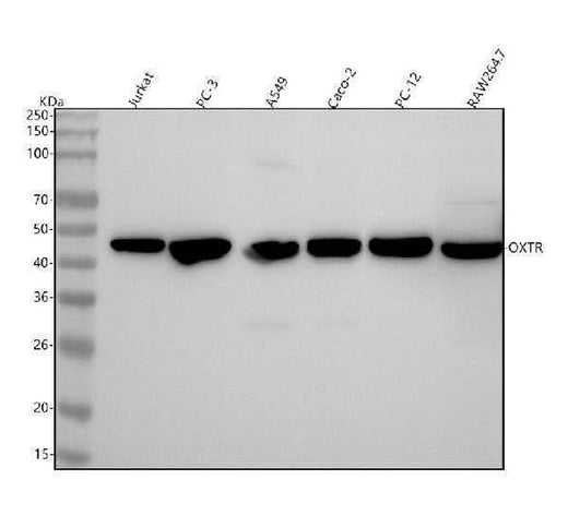 Anti-Oxytocin Receptor Rabbit Monoclonal Antibody Boster Bio