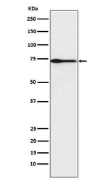 Anti-PROS1 Rabbit Monoclonal Antibody Boster Bio