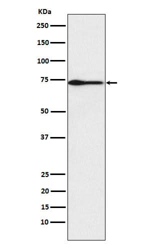 Anti-PROS1 Rabbit Monoclonal Antibody Boster Bio
