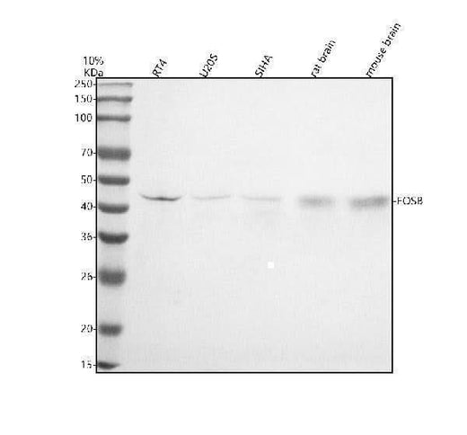 Anti-Fos B Rabbit Monoclonal Antibody Boster Bio