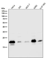 Anti-Caveolin-2 CAV2 Rabbit Monoclonal Antibody Boster Bio