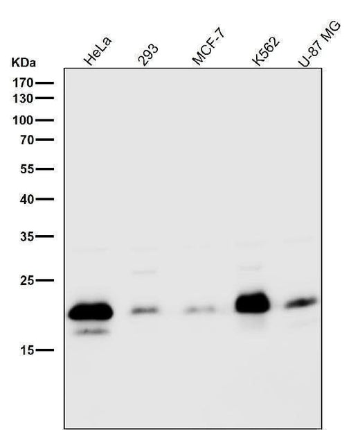 Anti-Caveolin-2 CAV2 Rabbit Monoclonal Antibody Boster Bio