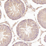 Anti-N-Cadherin-2 CDH2 CD325-Rabbit Monoclonal Antibody Boster Bio