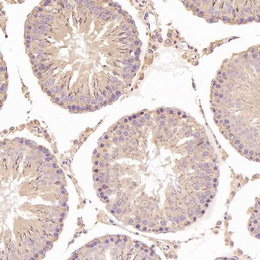 Anti-N-Cadherin-2 CDH2 CD325-Rabbit Monoclonal Antibody Boster Bio
