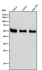 Anti-RAD52 Rabbit Monoclonal Antibody Boster Bio
