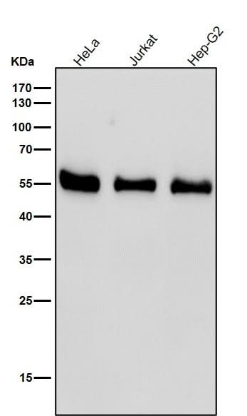 Anti-RAD52 Rabbit Monoclonal Antibody Boster Bio