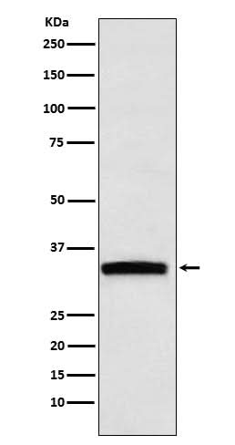Anti-GDF15 Rabbit Monoclonal Antibody Boster Bio